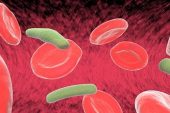 Leptospiroz Enfeksiyonu (Leptospirosis)